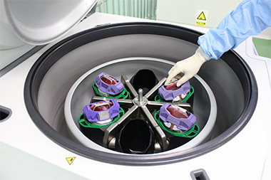  脐带血制备的离心 